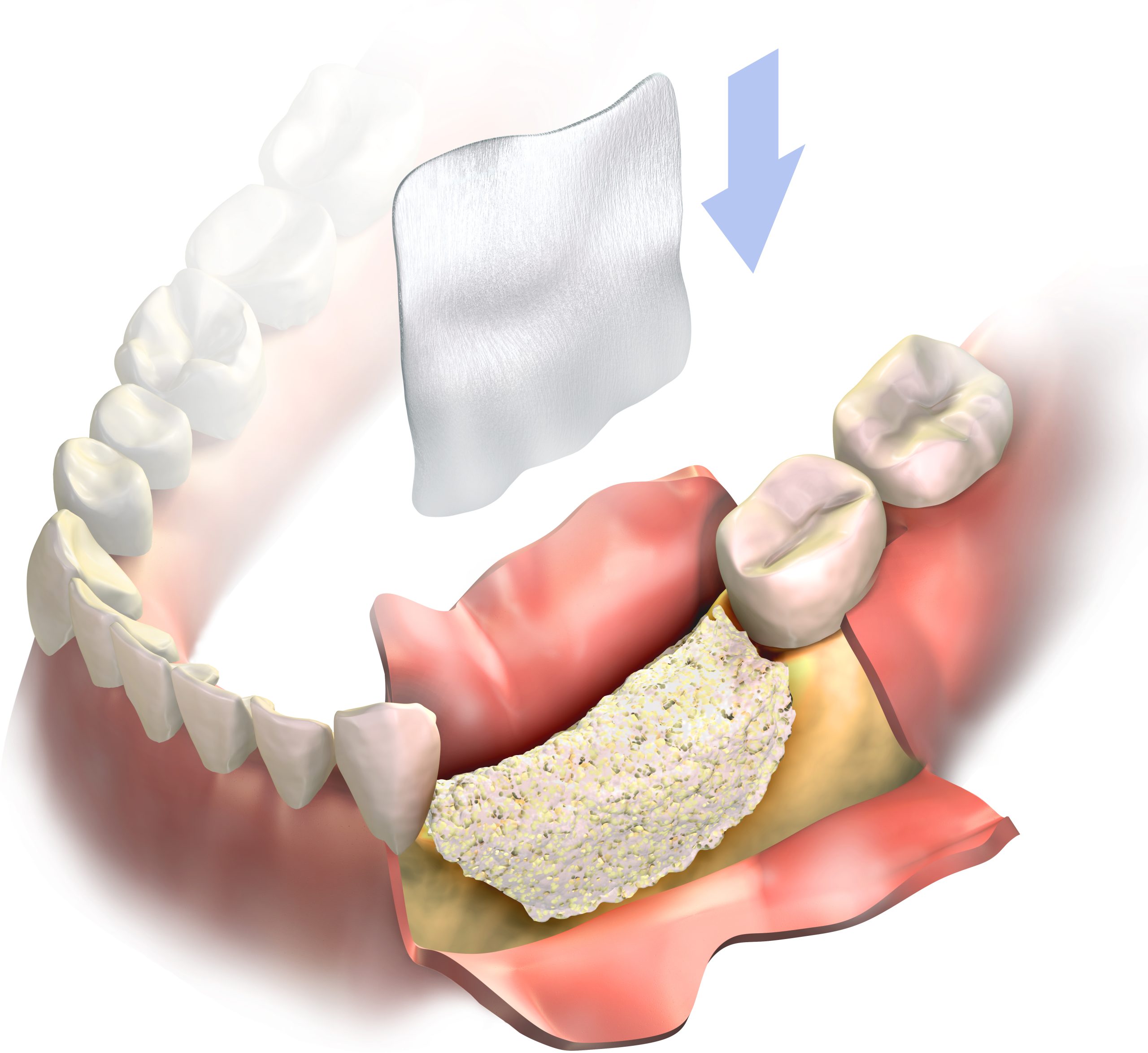 gingitex 3 scaled 1