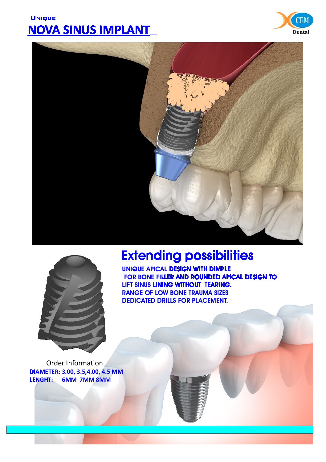 sinus nova imp leaf 1 pdf